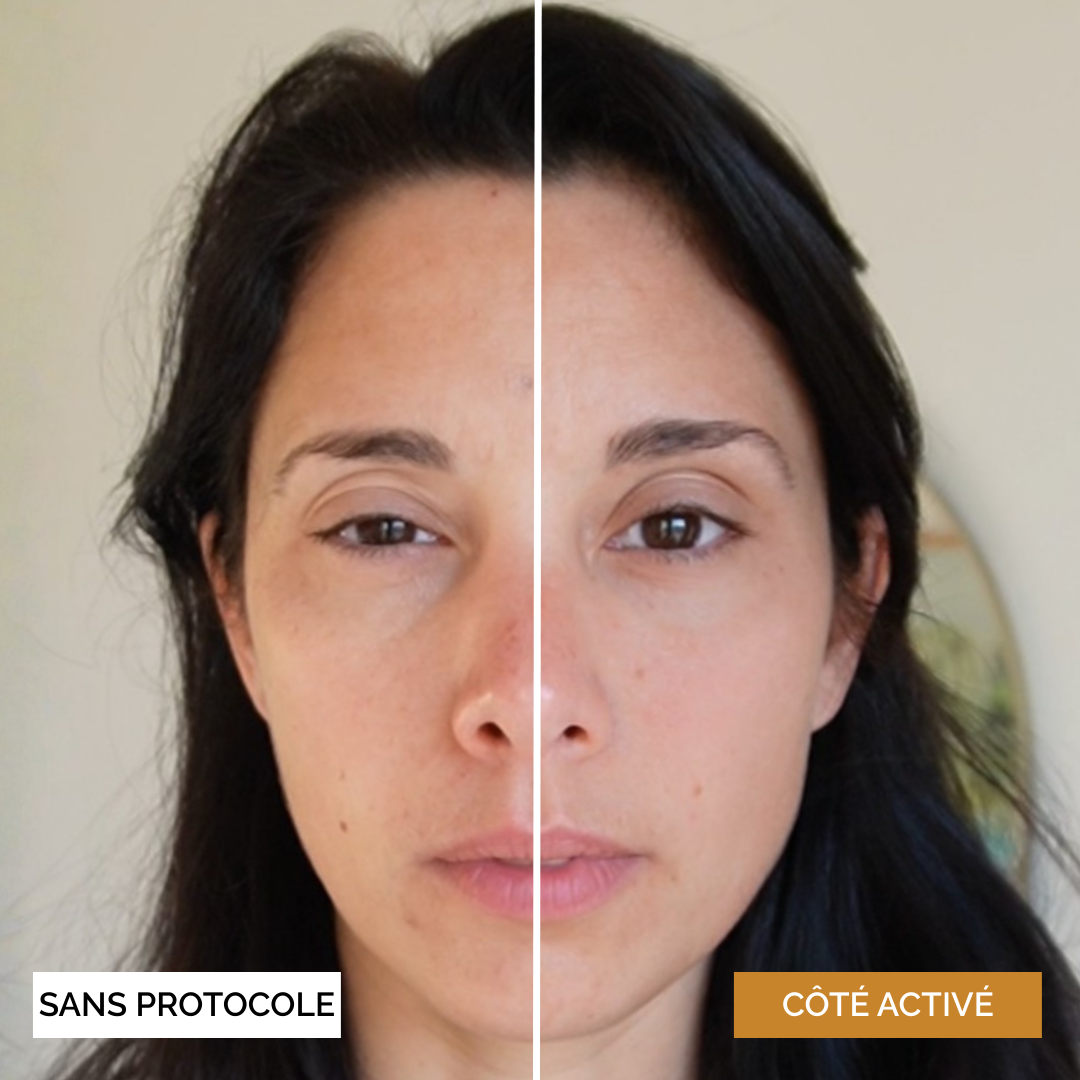 Protocole Activation